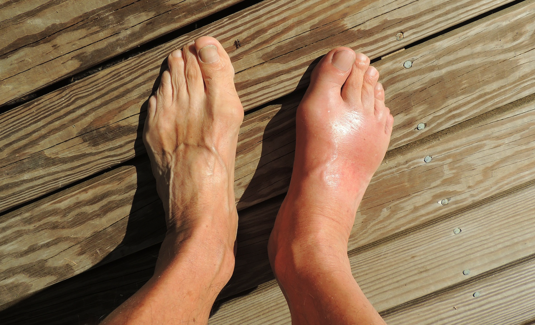 Podiatry | SoftWave Therapies Ohio 